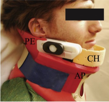 A-New-External-Upper-Airway-Opening-Device-Combined-With-a-Cervical-Collar-