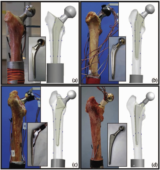 Patient-specific finite element analysis of femurs with cemented hip implants
